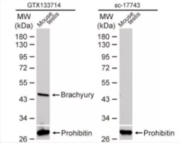 Brachyury antibody (GTX133714)