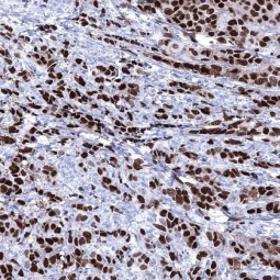 Progesterone Receptor antibody [MSVA-570R] HistoMAX (GTX04431)