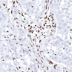 BRG1 antibody [MSVA-397R] HistoMAX (GTX04486) 