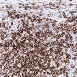 CD4 antibody [MSVA-004R] HistoMAX (GTX04379)