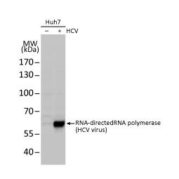 Hepatitis C Virus NS5A protein antibody