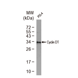 Cyclin D1 antibody [N1C3]