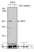 Anti-ZO-1 antibody used in Western Blot (WB). GTX108592