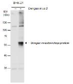 dengue virus envelope protein抗体