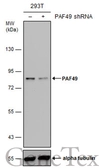 Anti-PAF49 antibody [GT635] used in Western Blot (WB). GTX629076