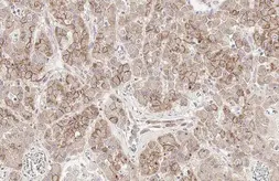 Anti-E-Cadherin antibody [HL1228] used in IHC (Paraffin sections) (IHC-P). GTX636576