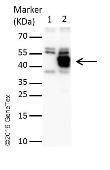 Zika Virus Ns Protein Gtx Genetex